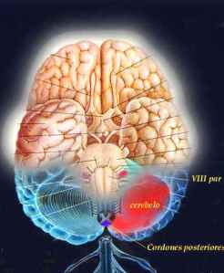 cerebro parkinson
